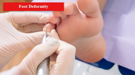 AusFeet Podiatry Hero Image