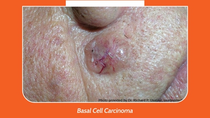 Port Macquarie Skin Cancer Clinic Hero Image