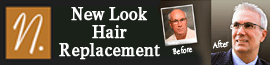 New Look Hair Replacement logo