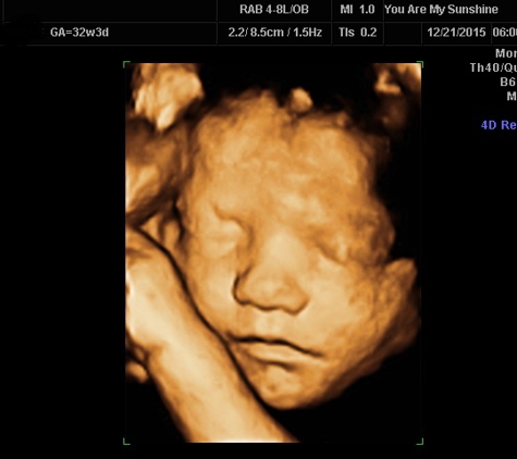 You are my Sunshine 3D/4D Ultrasound & Photography - Enid, OK