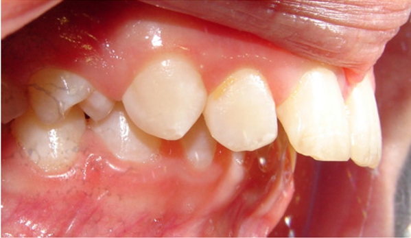 Active Orthodontics - Maryborough, QLD