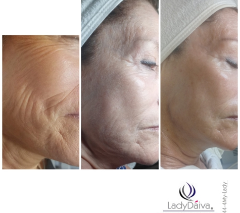 Lady Daiva Skin Care - Fort Myers, FL. Anti-Aging Treatment