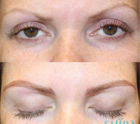 Shira Laser Aesthetics - Brooklyn, NY. Never underestimate the power of an eyebrow ������������✨