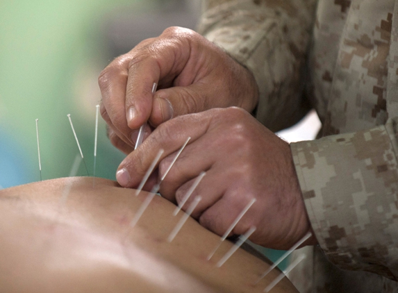 Acupuncture & Traditional Chinese Medicine - Rangeville, QLD