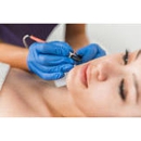 Electrolysis By Susan Hanson - Hair Removal