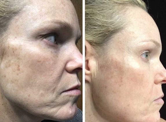 French Medical Group - Elgin, IL. Personal Before & After