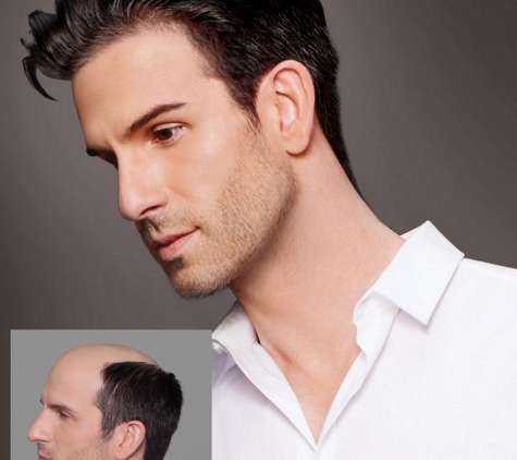 Elite  Hair Loss Solutions - Gold River, CA