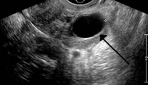 Dr Amrou Metawa - North Gosford, NSW. Obstetrics & Gynaecology