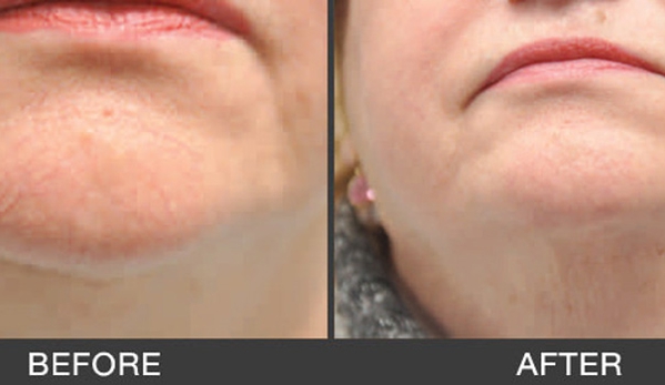 South Coast Skin & Vein Clinic - Wollongong, NSW