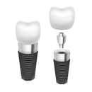 Dental Implants Factory - Dental Clinics