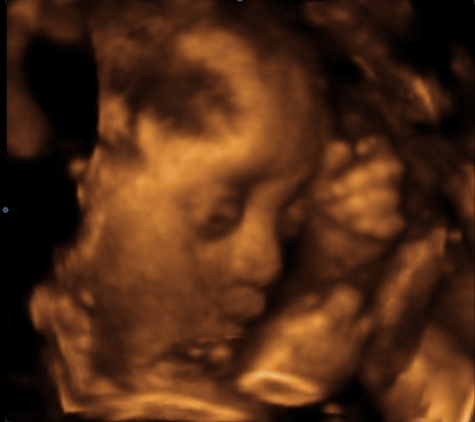 Sneak-A-Peek Prenatal Imaging of Mobile - Mobile, AL