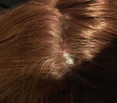 MariMar Beauty Hair & Distribution - Los Angeles, CA. Those red marks are scalps of blood from bleaching leaving for to long