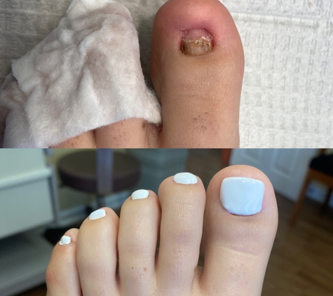 Smith Medical Pedicures - Monterey, CA