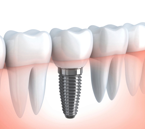 Carousel Dental Centre - Cannington, WA