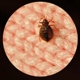 Sleeptite Thermal Bedbug Extermination, LLC