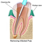 Beavercreek Endodontics Associates