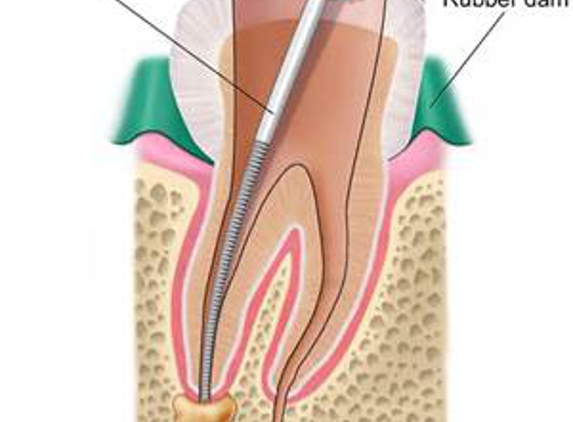 Beavercreek Endodontics Associates - Dayton, OH