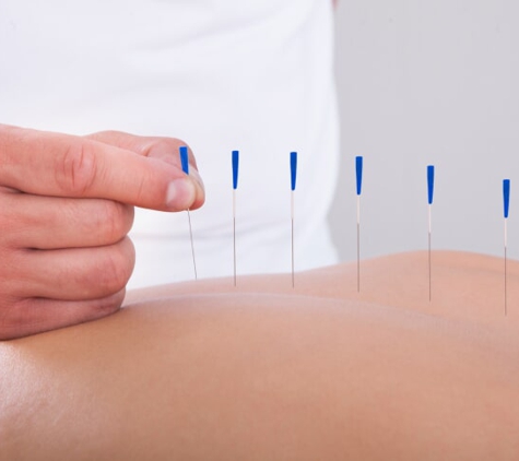 Acupuncture & Traditional - Littleton, CO