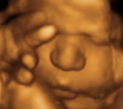 A New Conception 3D Ultrasound Studio - Hanover, MA