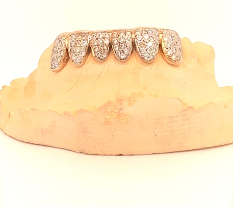 Custom Gold Grills - Seattle, WA