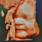 Love At First Sight 3D/4D Ultrasound Imaging Studio