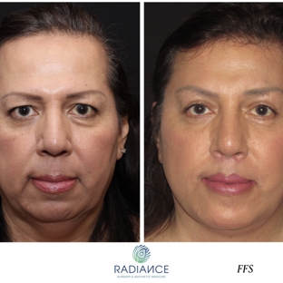 Dr. Cang C Huynh, MD, DMD - Atlanta, GA. Facial Femininization Surgery