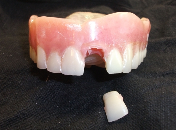 Denture Repairs by Lori - San Diego, CA