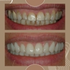 Dr. James Slaman DDS, PC gallery