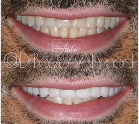 Dr. Borzoo Ahmadi DDS - West Hollywood, CA