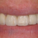 Glenlake Dental Care - Dentists