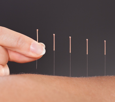 Awakening Balance Acupuncture - Northglenn, CO. Hair-thin needles, painless.