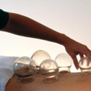 Ocean Acupuncture & Wellness Center - Acupuncture