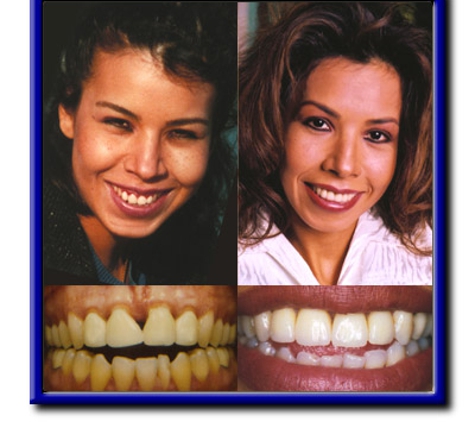 Jerome A. Guttman DDS - Playa Del Rey, CA