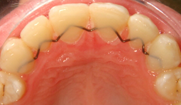 Hunter Valley Orthodontics - Singleton, NSW