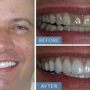 Almeida & Bell Dental Lone Tree - General, Cosmetic, and Implant Dentistry