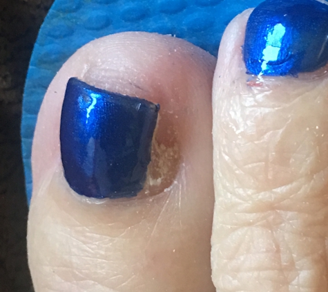 Bella Nails and Spa - Sedalia, MO. Right foot: Side of nail missing 1/2 way thru nail bed