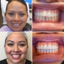 Fort Worth Dental Arts - Cosmetic Dentistry