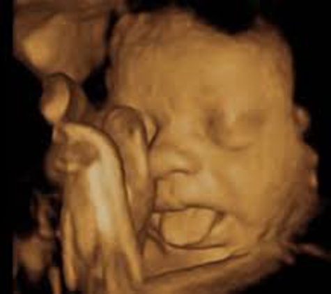 Ultrasound at Home, L.L.C. - Avondale, AZ