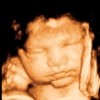 Clear Image 4D Ultrasound gallery
