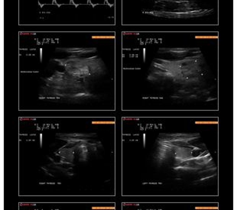 Diagnostic Medical Imaging - Marc H Simonson MD - Union City, NJ