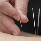 Acupuncture AAA & I