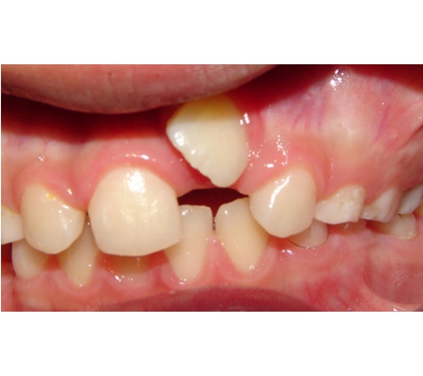 Active Orthodontics - Bundaberg South, QLD