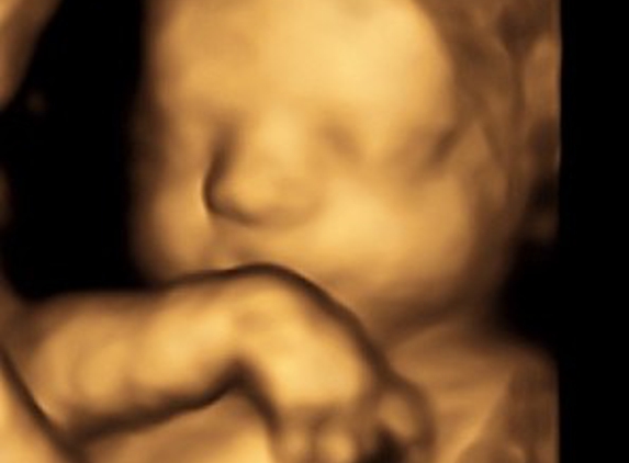 Bundle of Love 3D/4D 5D HDLive Ultrasound & Baby Boutique - Gastonia, NC. 15 weeks 3D