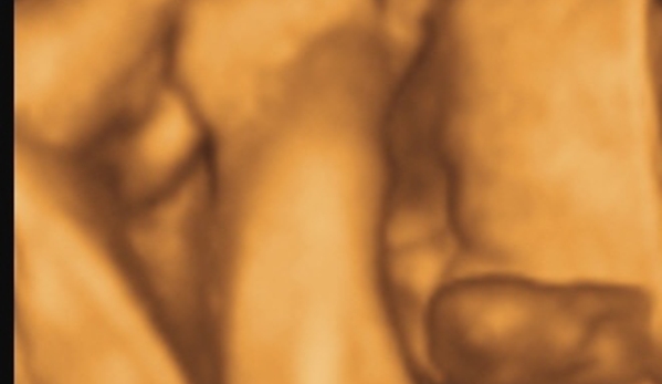 TLC Imaging 3D/4D Ultrasounds - Reynoldsburg, OH