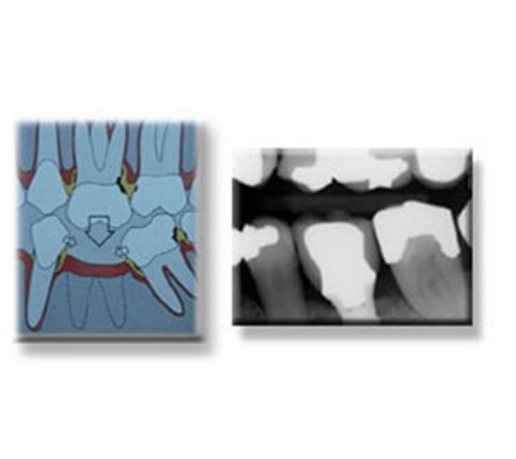 Moggill Road Dental - Taringa, QLD