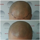 Scalp Aesthetics Los Angeles - Permanent Make-Up