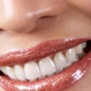 Ryan M. Meyer DDS - Teeth Whitening Products & Services