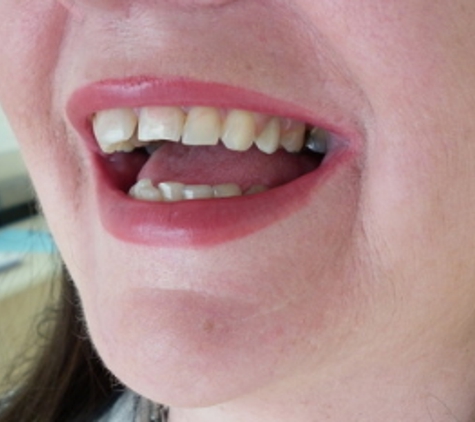 Balwyn Denture Clinic - Balwyn, VIC