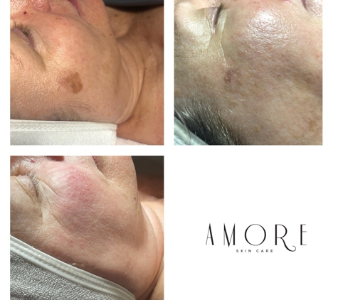 Amore Skincare & Beauty - Louisville, KY