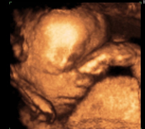 TLC Imaging 3D/4D Ultrasounds - Reynoldsburg, OH